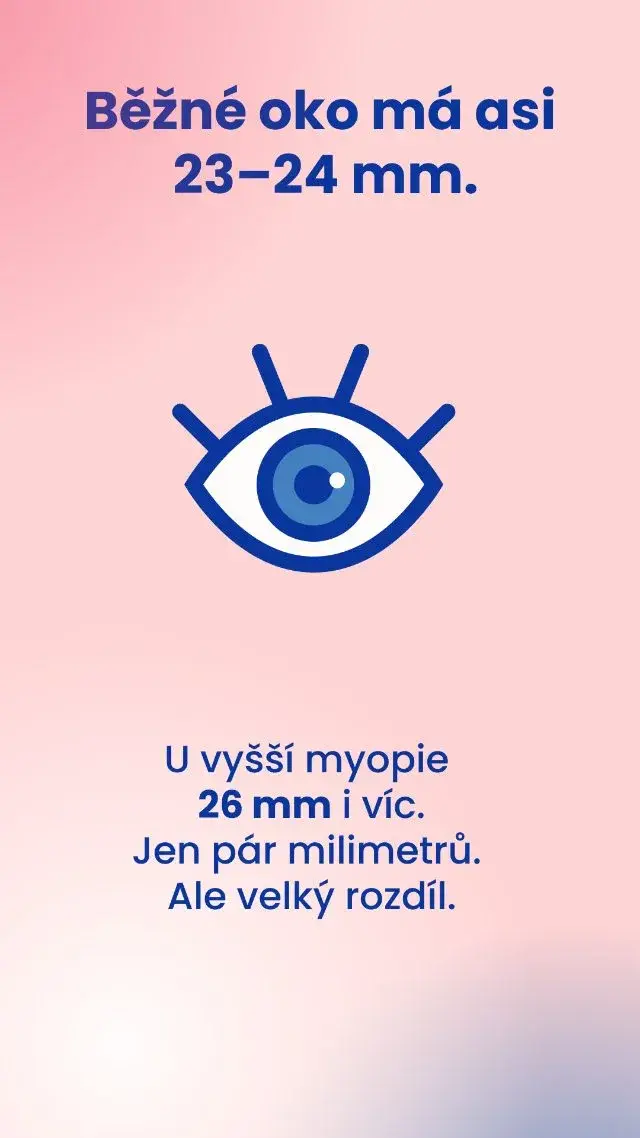 Běžné oko má asi 23-24 mm, u vyšší myopie 26 mm i víc
